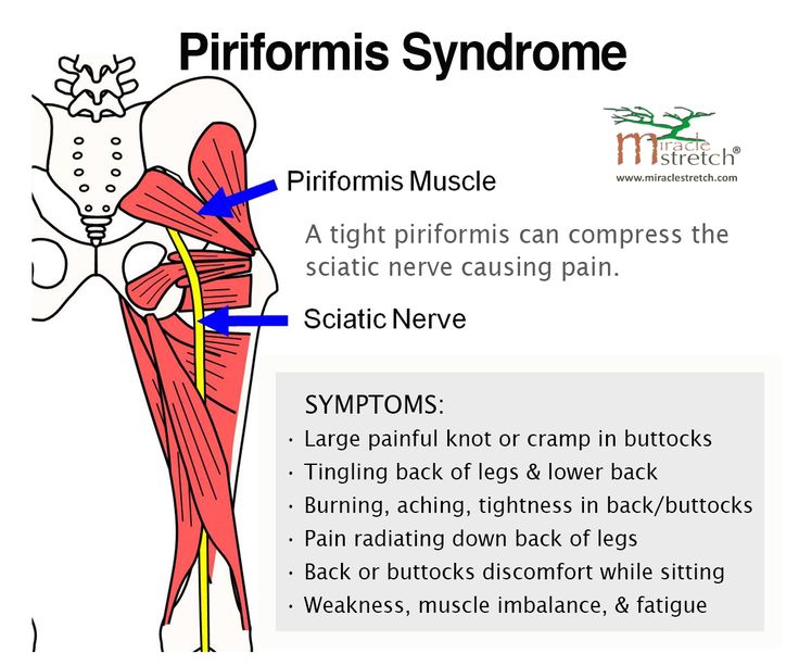 piriformis